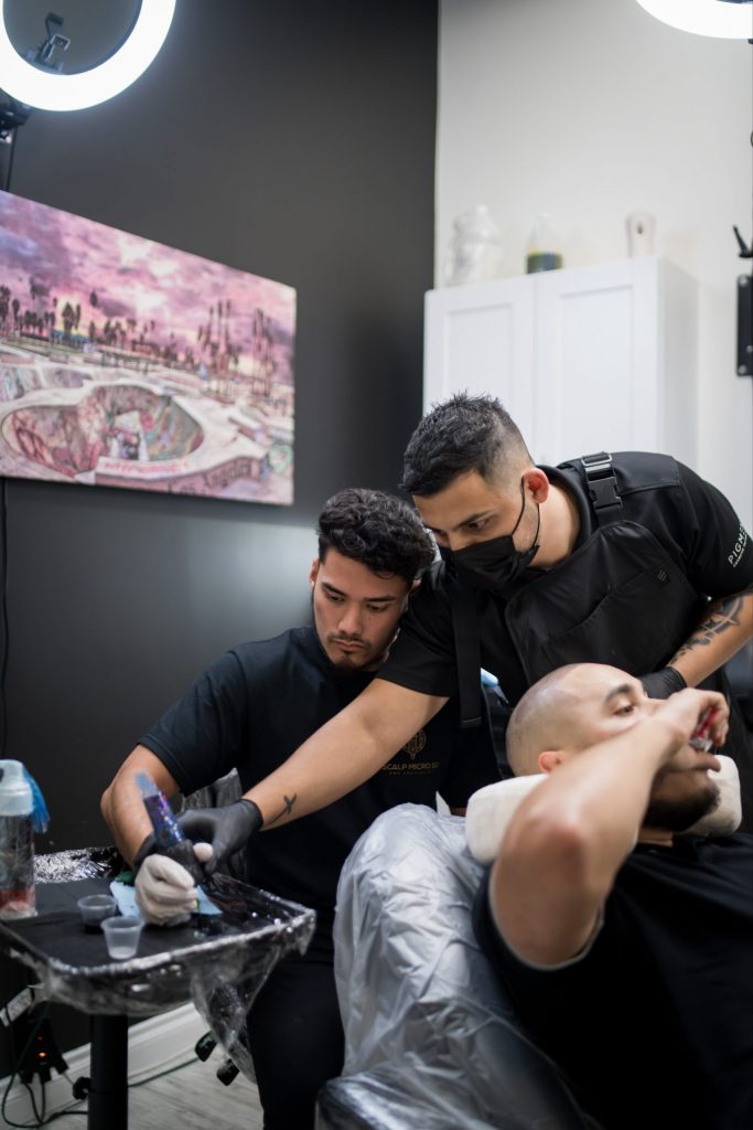 Scalp Micropigmentation Results